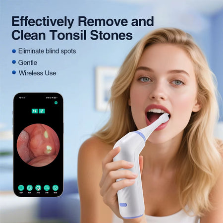 Visible Tonsil Stone Remover with 300K HD Camera Tonsil Stone Removal Kit 3 Suction Modes Tonsil Stone Removal Oral Care Health