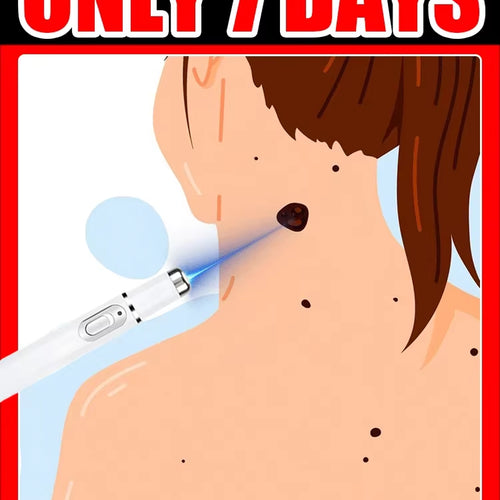 Load image into Gallery viewer, Wart Care Tools，Hot Selling Blue Light Pen to Solve Body Warts
