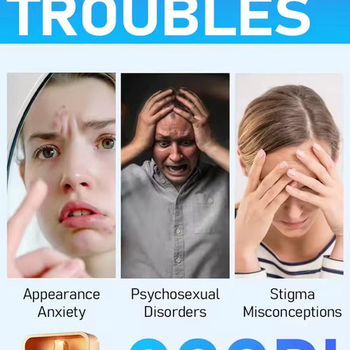 Load image into Gallery viewer, Wart Care Tools，Hot Selling Blue Light Pen to Solve Body Warts
