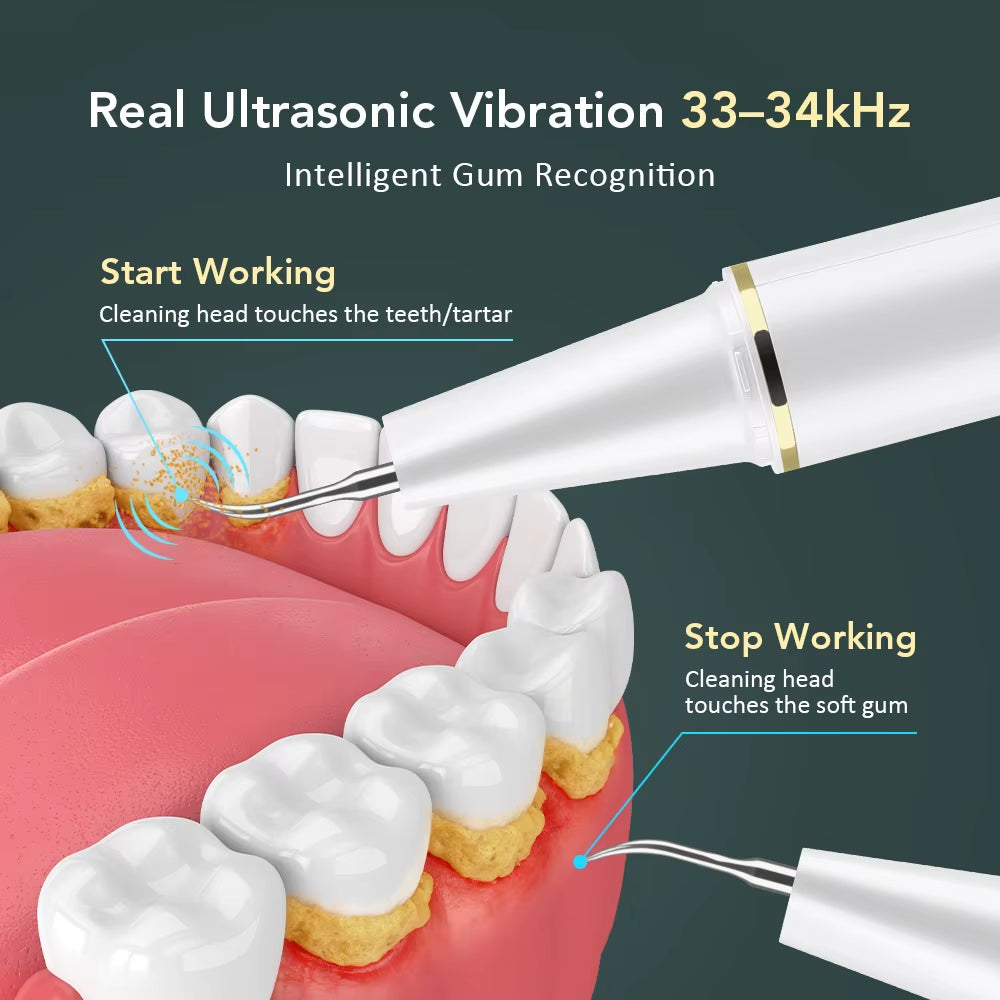 Visual Ultrasonic Teeth Cleaner Calculus Plaque Remover 3 Modes Ultrasonic Dental Scaler for Tooth Cleaning Whitening Oral Care