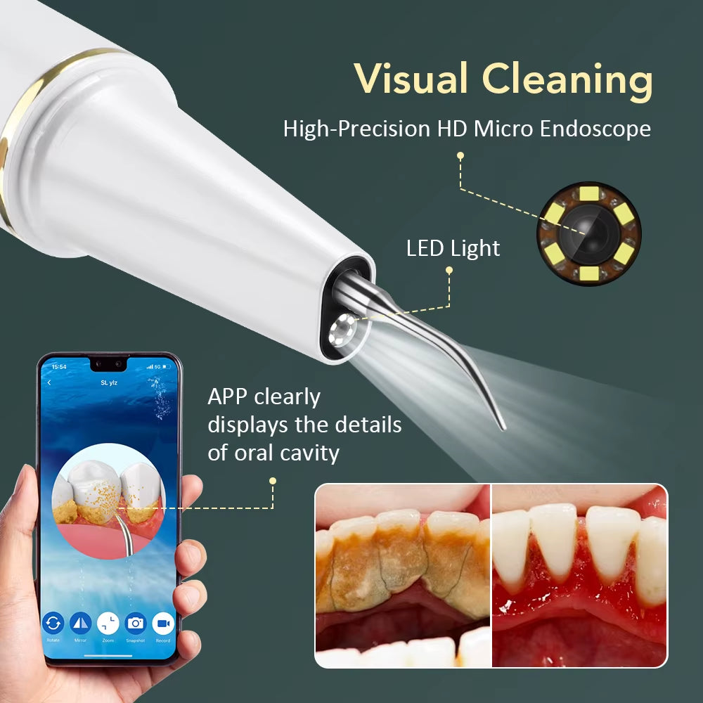 Visual Ultrasonic Teeth Cleaner Calculus Plaque Remover 3 Modes Ultrasonic Dental Scaler for Tooth Cleaning Whitening Oral Care
