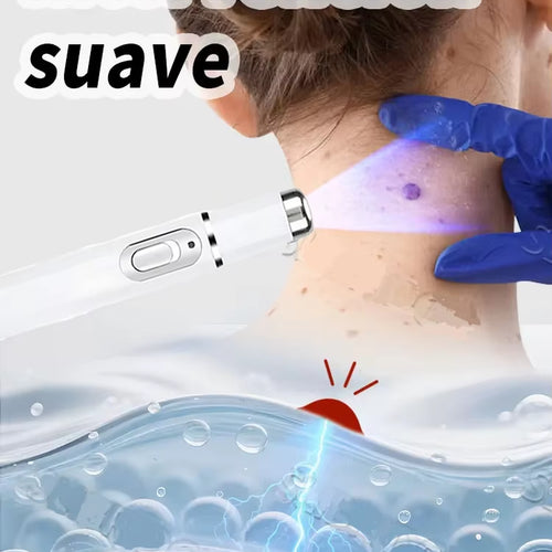 Load image into Gallery viewer, Wart Care Tools，Hot Selling Blue Light Pen to Solve Body Warts
