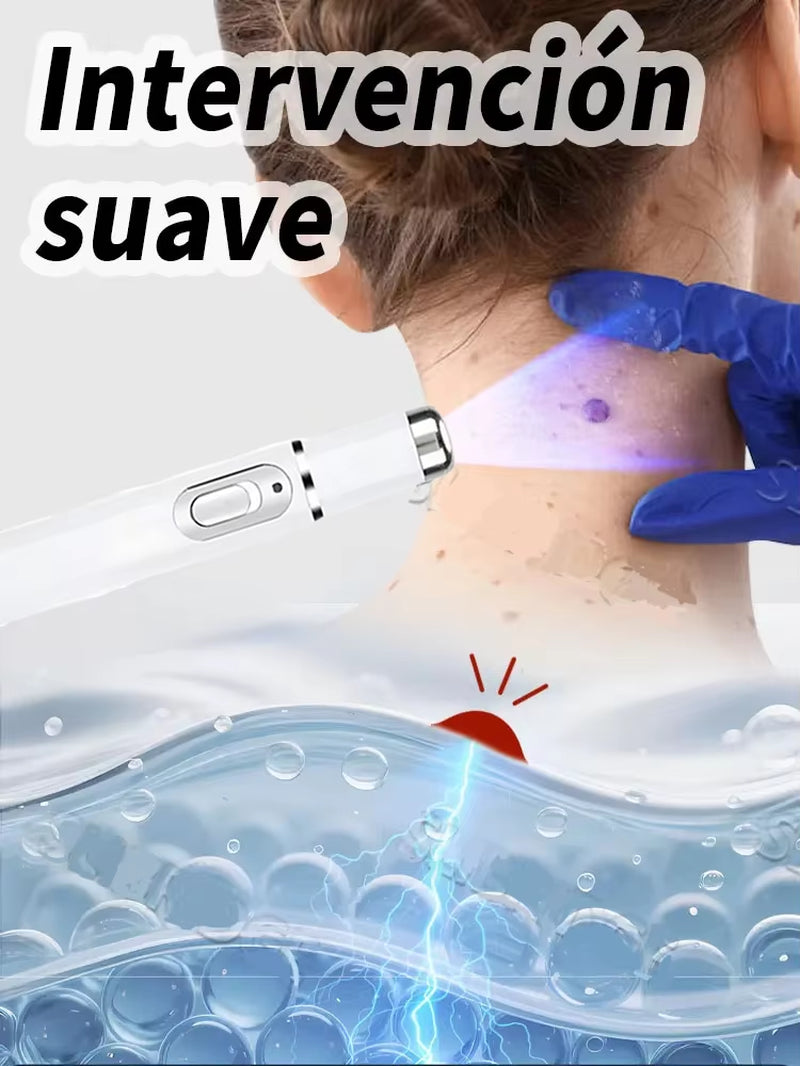 Wart Care Tools，Hot Selling Blue Light Pen to Solve Body Warts